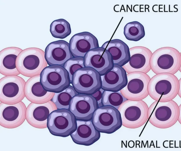 Cellular Therapy for Cancer by Best Oncologist in Haryana