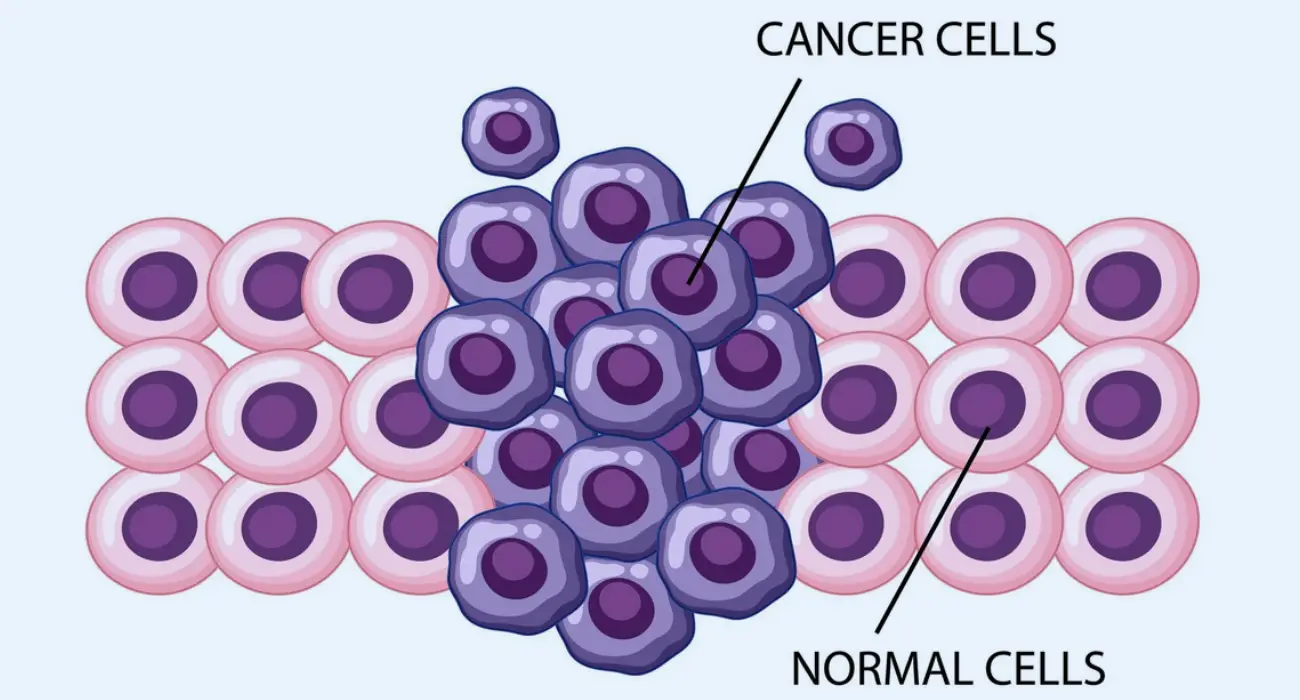 Cellular Therapy for Cancer by Best Oncologist in Haryana