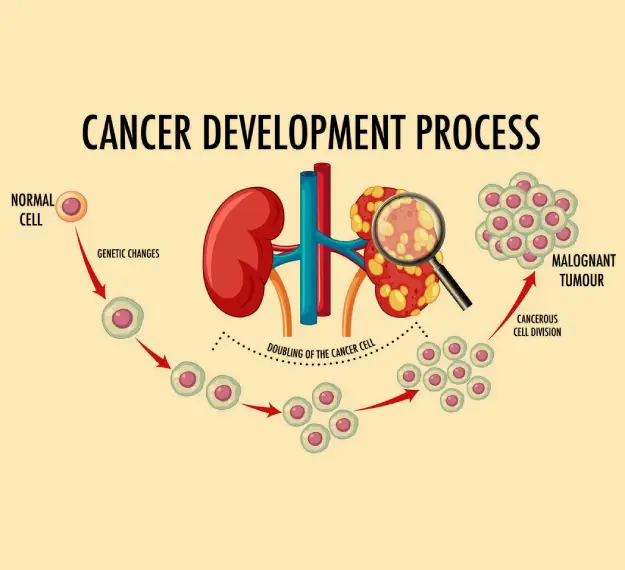 Advanced Uro Oncology Treatment