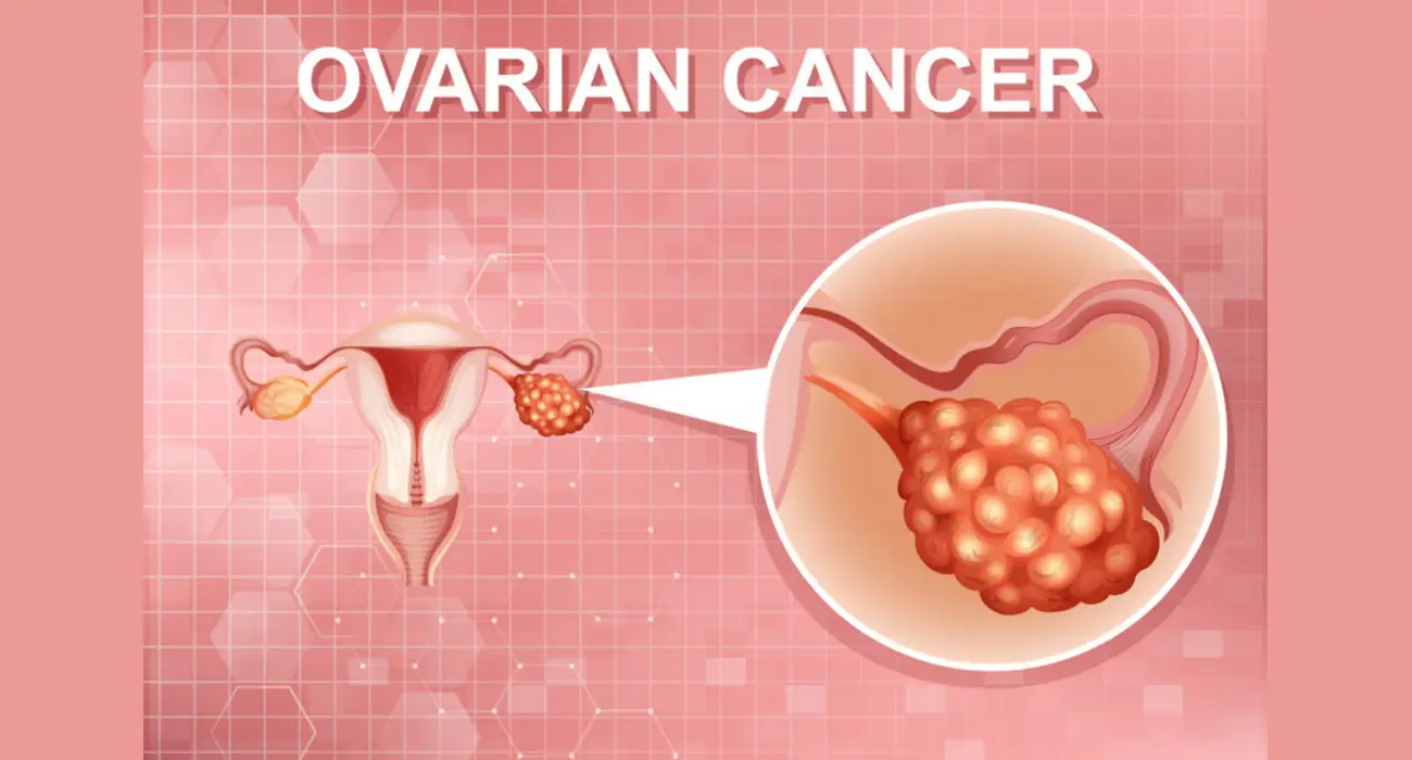 Best Ovarian & Uterine Cancer Treatment in Haryana