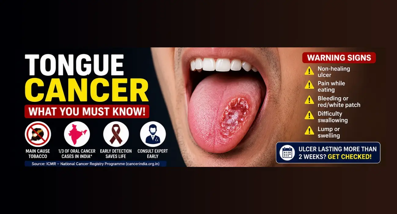 Affordable Tongue Cancer Treatment in Haryana